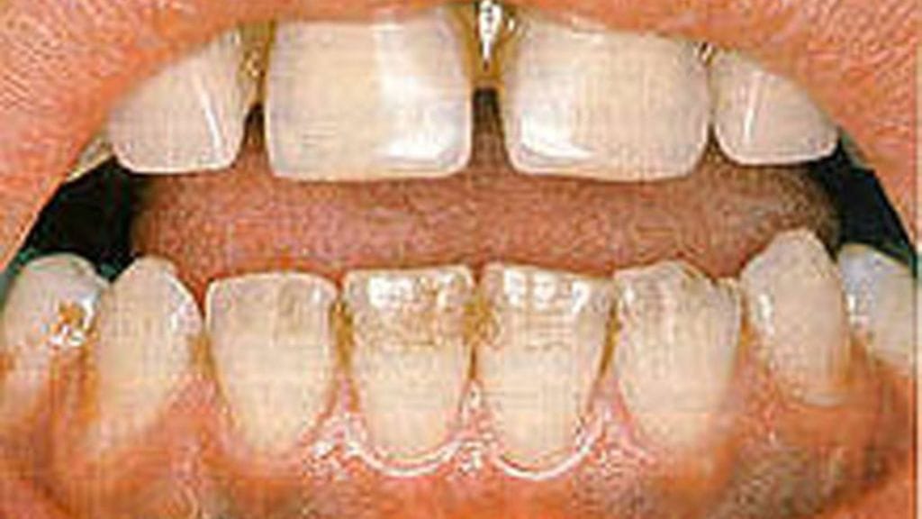 Tämä ei ole vielä edes pahin mahdollinen tilanne.