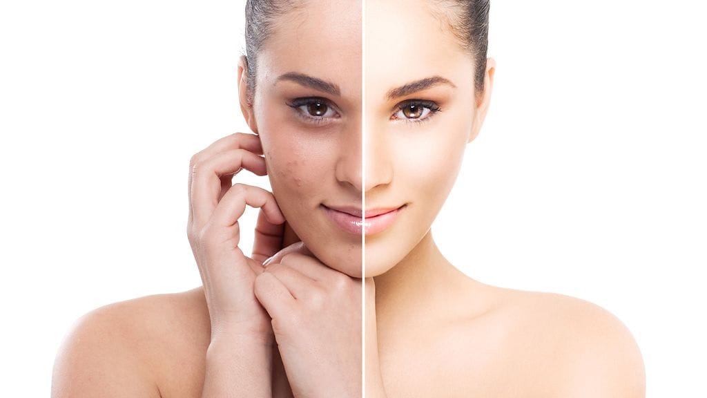 Tuntuuko ihosi samealta? Kokeile kuorintaa.