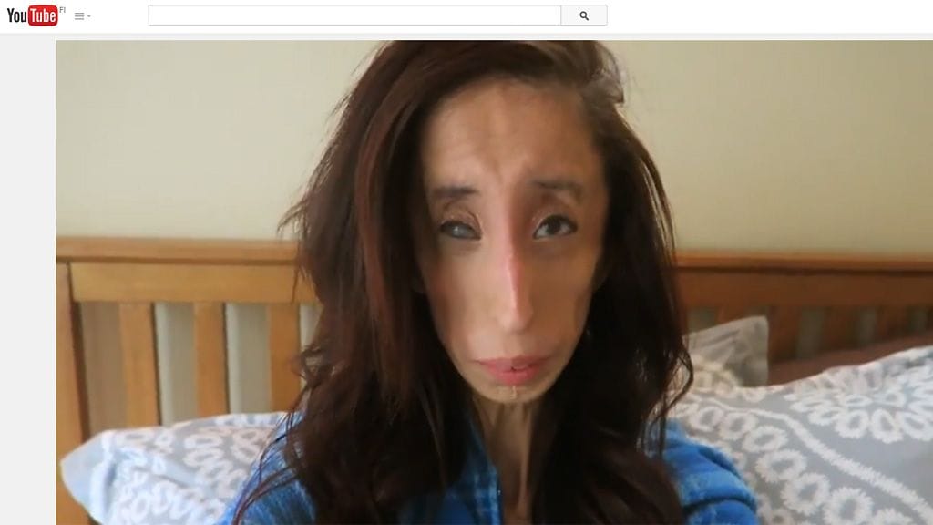 Kuvakaappaus Lizzie Velasquezin YouTube-videosta.