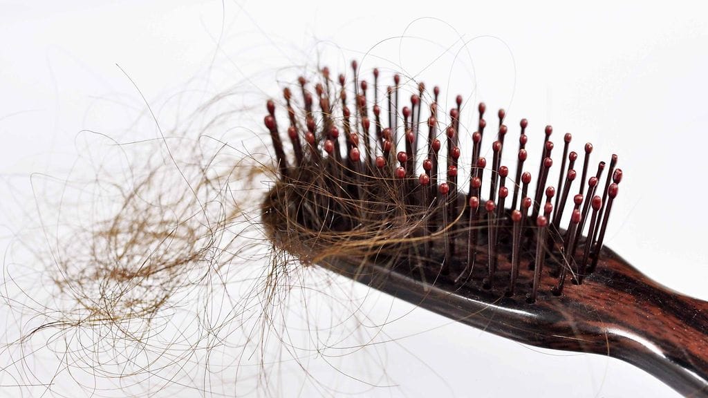 Hiustenlähtöön vai vaikuttaa esimerkiksi yksipuolinen ruokavalio.