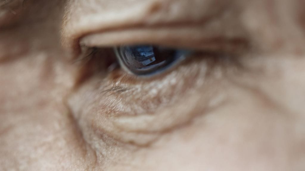 Kaihi havaitaan usein pitkälle edenneenä. Kuvituskuva.