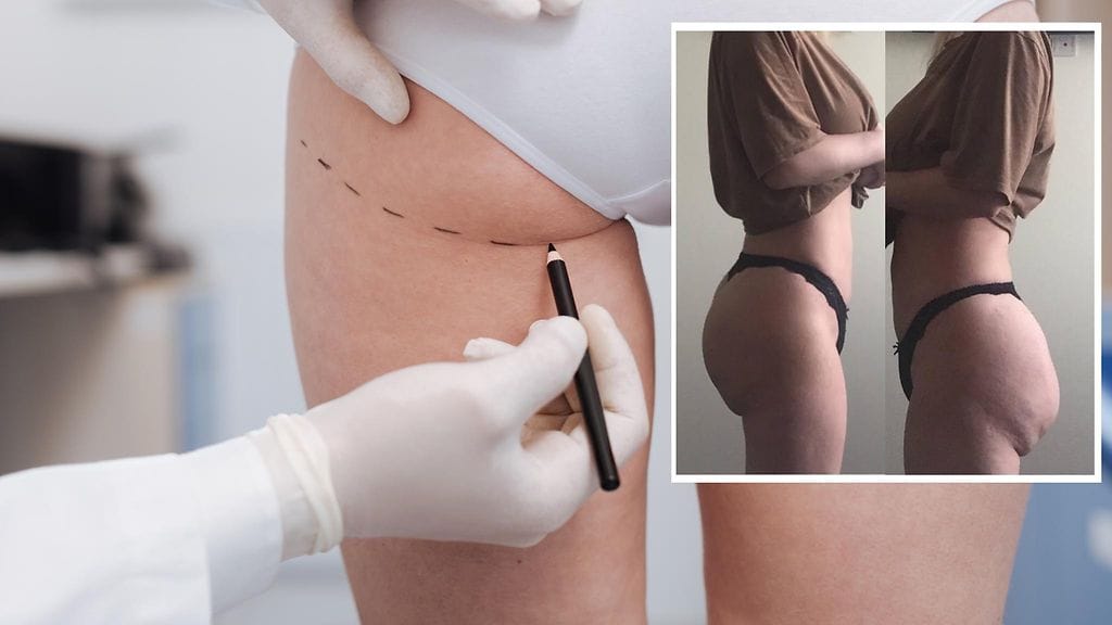 Virolaisen kirurgin suorittama leikkaus ei vastannut lainkaan odotuksia.