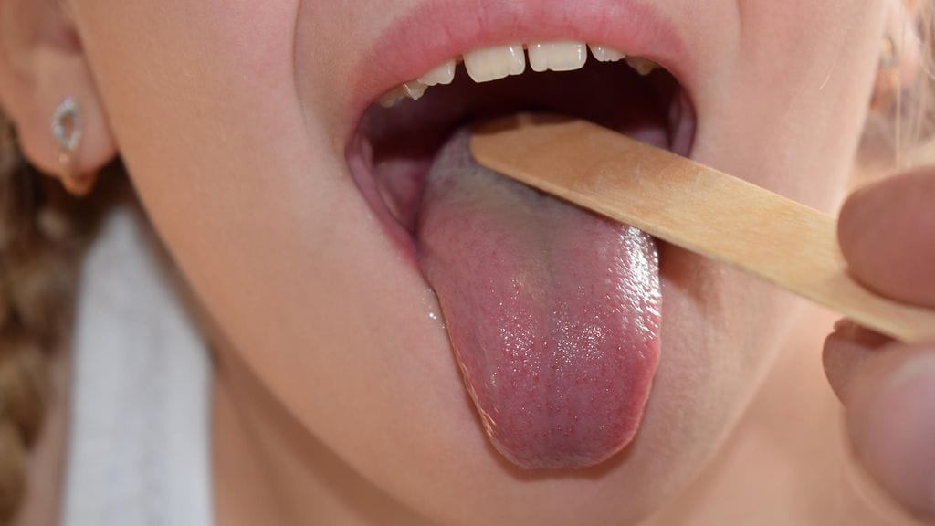 Lääkäri erehtyi taudinkuvasta.