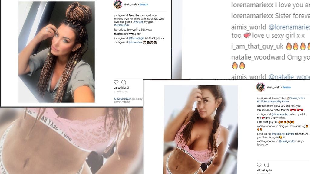 Aimi Veness on käyttänyt jo noin 110 000 euroa kauneusleikkauksiin. Kuvien lähde Instagram