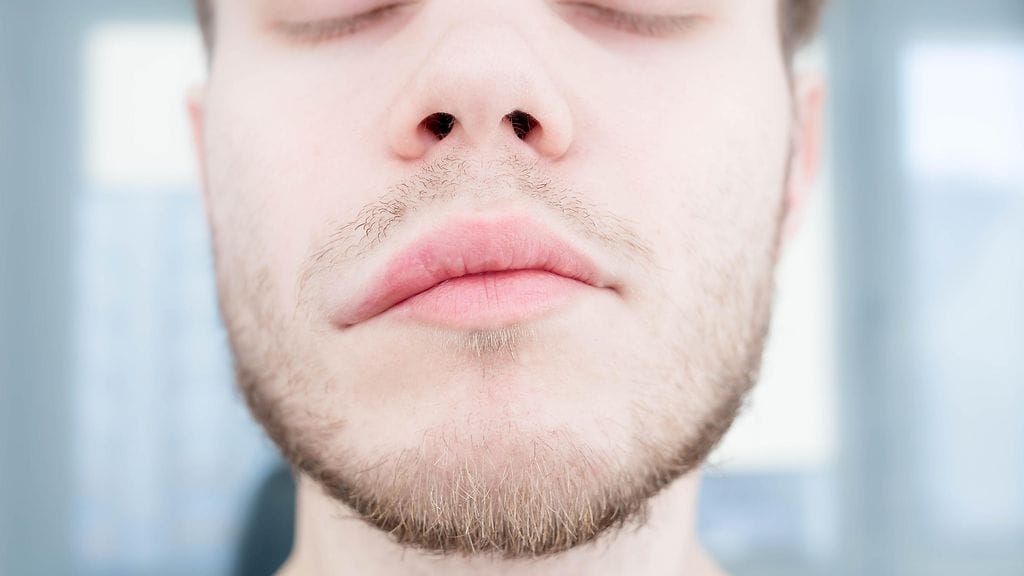 Kasvojen toispuoleinen halvaus on yksi aivoinfarktin oireista. Kuvituskuva.