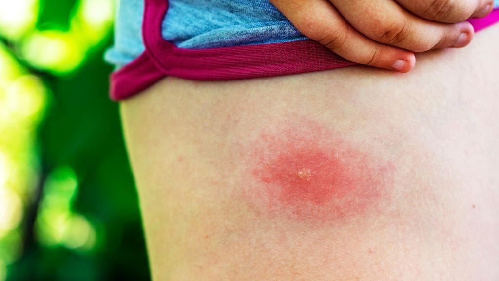 shutterstock_1160743969