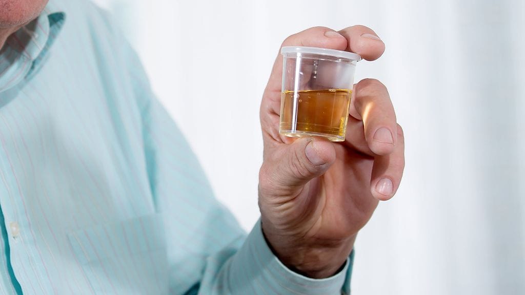 Amerikkalaismies sai virtsanäytteen suihkuverhon sijaan. Kuvituskuva.