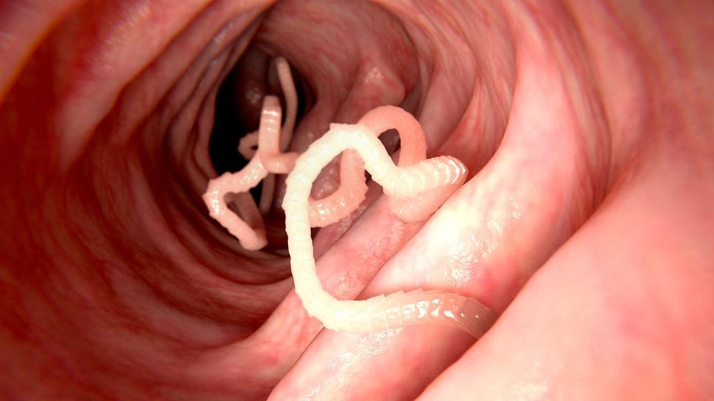 Kapea heisimato voi aiheuttaa systiserkoosin. Kuvituskuva.