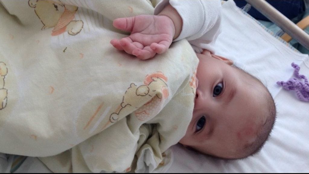 Väinö Kawasakin tauti ihottumaa