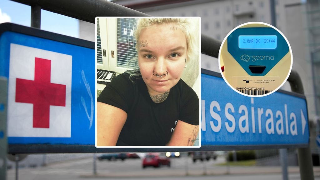 Neljä viikkoa hoitoa kokeillut Ida Niemelä olisi valmis testaamaan tasavirtastimulaatiota uudelleen.