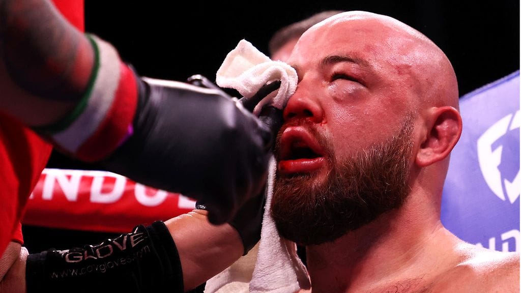 Adam Kownackin silmä oli muurautunut Robert Heleniuksen käsittelyssä pahasti umpeen.