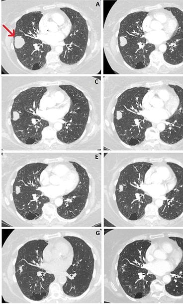 bmjcr-2021-September-14-10--F2.large