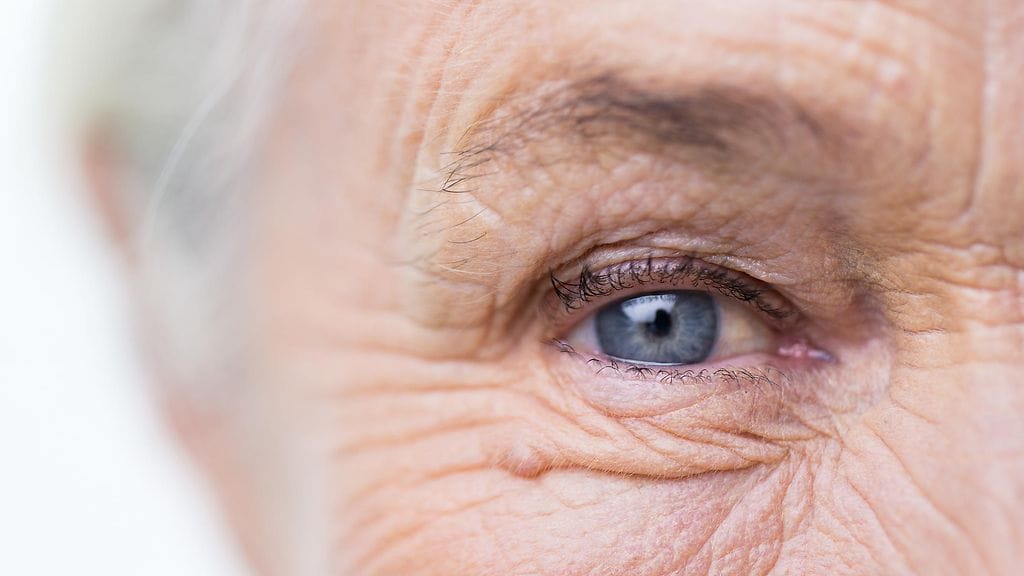 ikääntyneen silmät