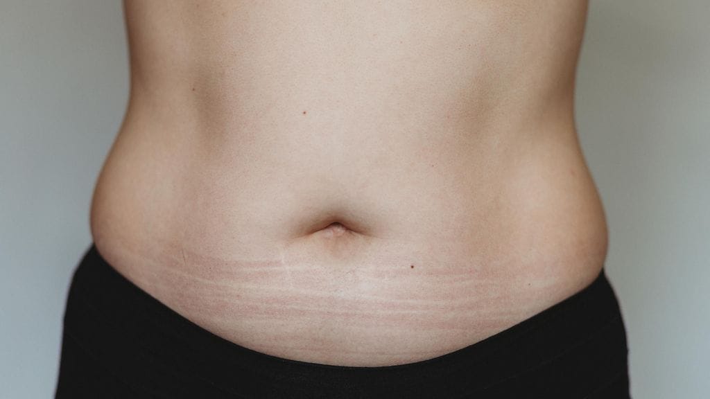 napa, vyötärö, maha