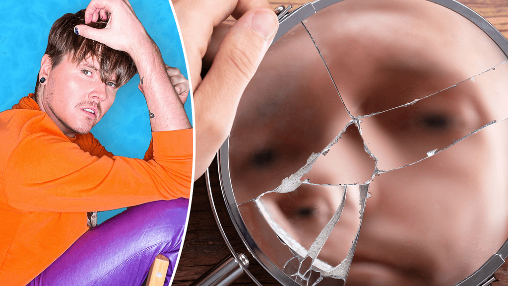 Syöpähoitojen johtama hiustenlähtö on nakertanut Eino Nurmiston itsetuntoa.