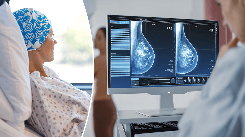 17 syövän havaittiin lisääntyneen enemmän nuorissa.