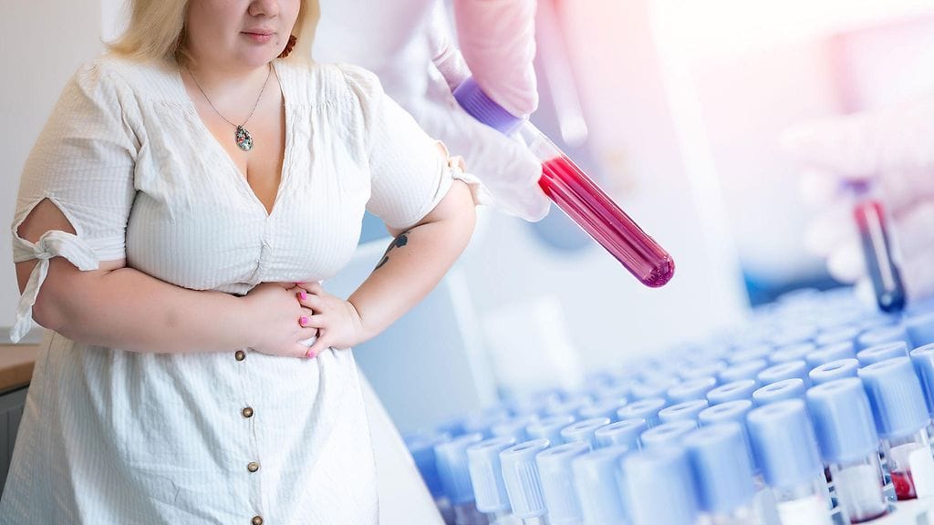 Jos vatsasi ei ole koronapandemian jälkeen ollut ennallaan, et ole yksin.