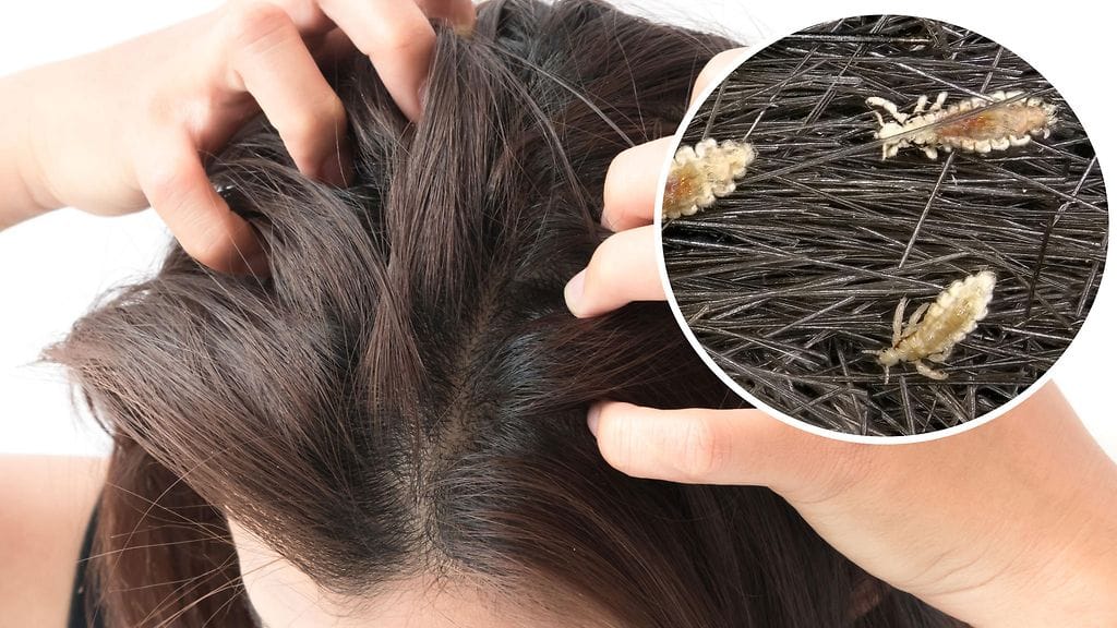 Miten täitä saadaan ja kehen ne voivat iskeä?