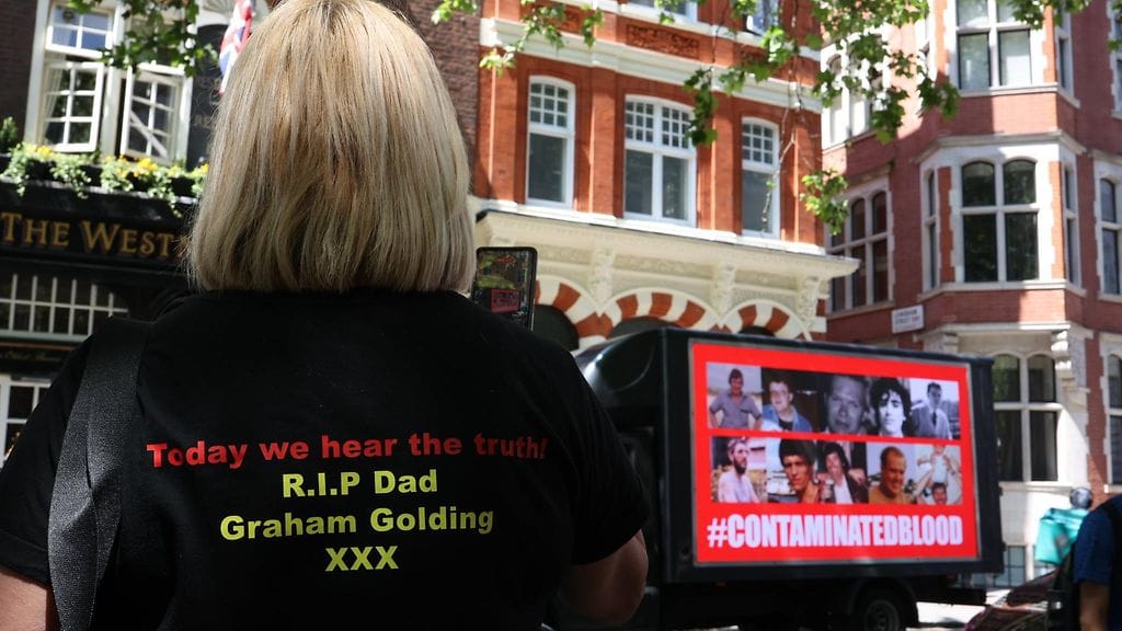 30 000 ihmistä sai saastunutta verta ja verituotteita Britannian valtion rahoittamasta kansallisesta terveyspalvelusta (NHS) vuosina 1970–1991.