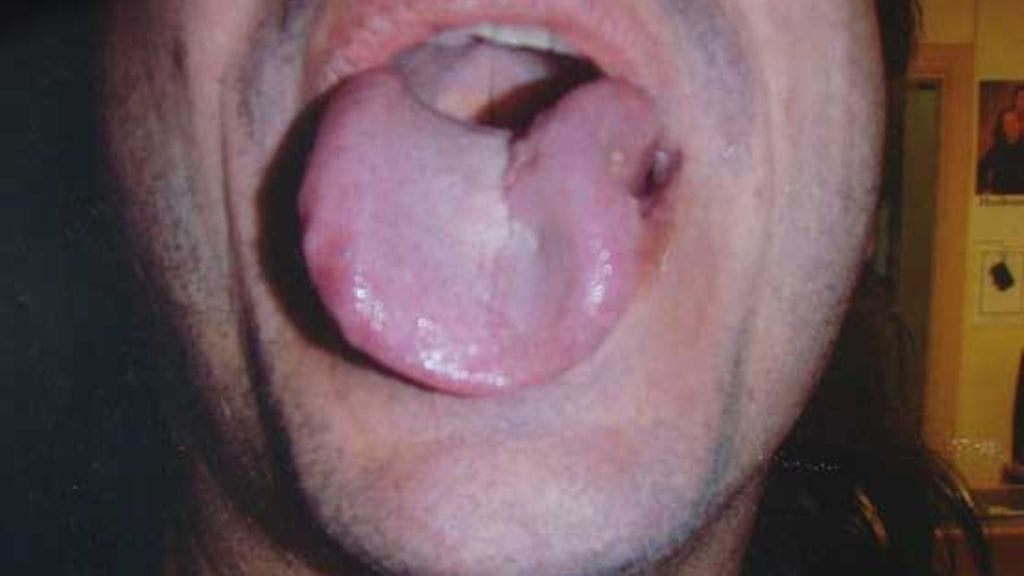 Hannun kieli on yhä pahassa kunnossa.