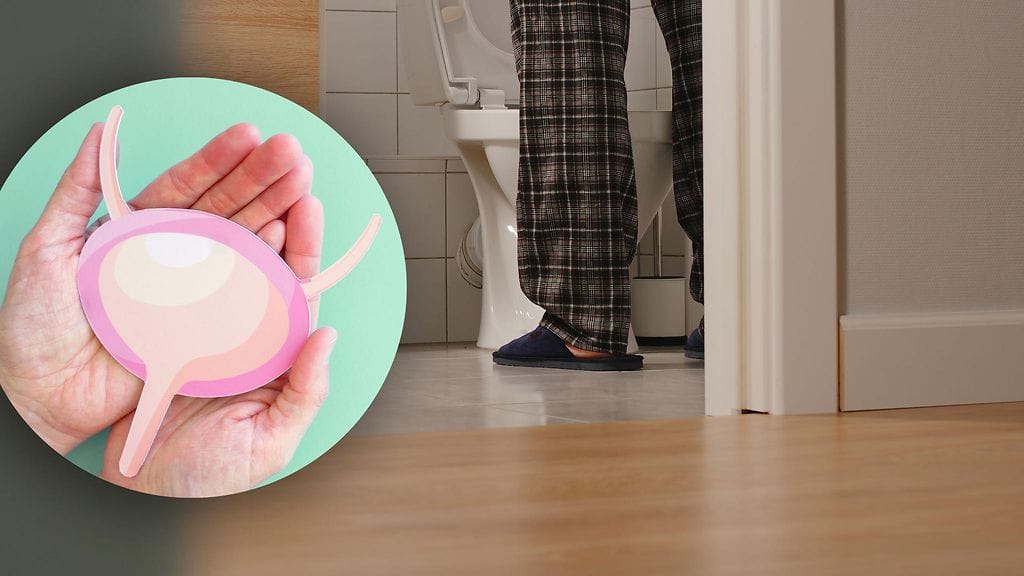 Yövirtsaaminen on monimutkainen asia.