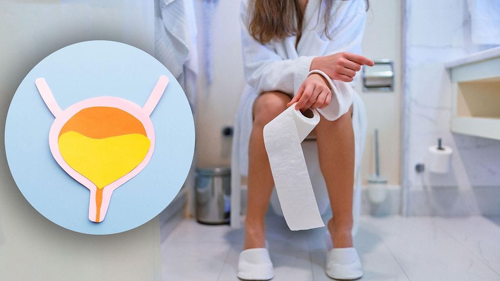 Virtsaumpi ei katso sukupuolta.