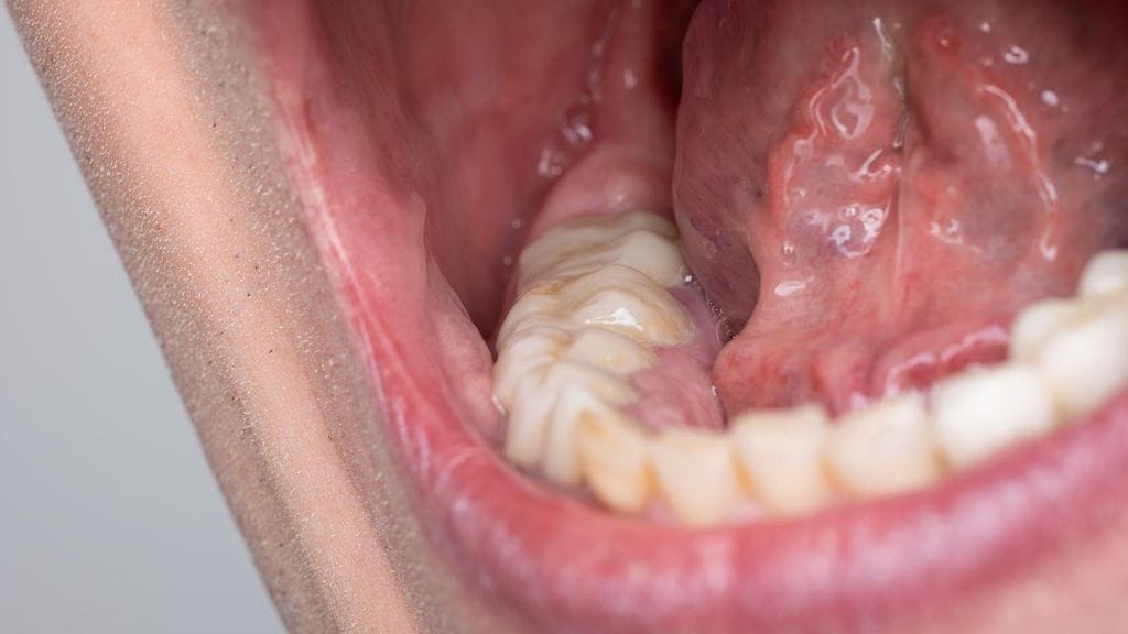 42 hampaalla pääsi ennätystenkirjaan. Kuvituskuva.